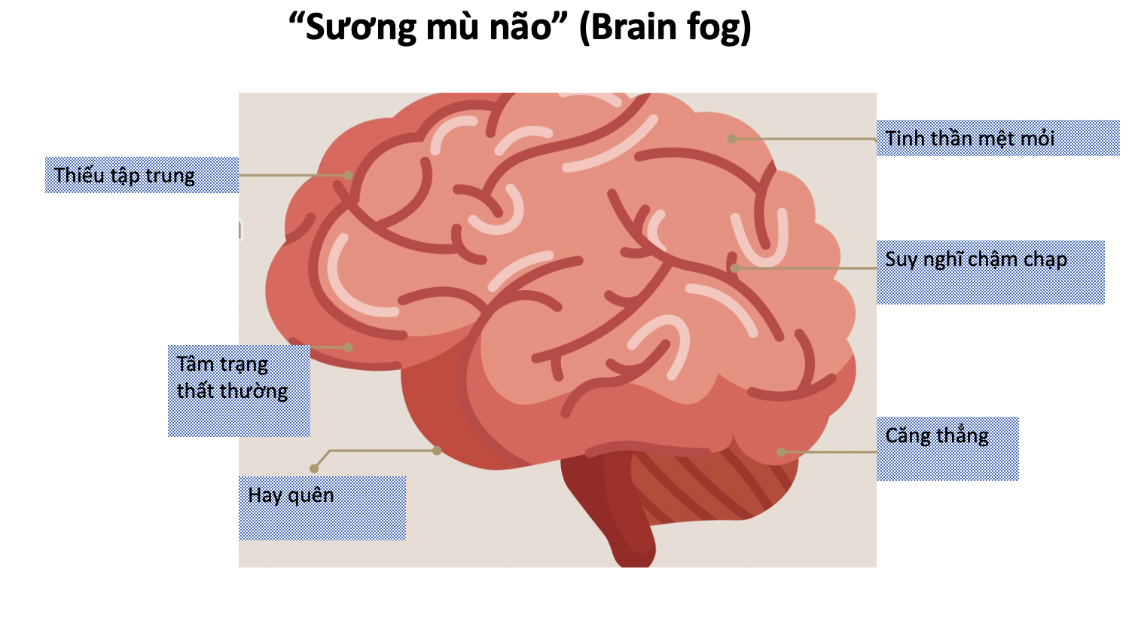 Sương mù não (Brain fog).