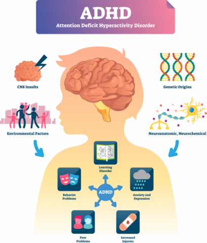 ADHD được chia ra làm ba dạng chủ yếu gồm có quá hiếu động, hấp tấp và giảm khả năng tập trung chú ý của trẻ.
