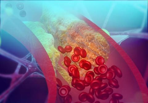 Nghiên cứu đã phát hiện các loại rau giàu sulforaphane giúp giảm mức cholesterol “xấu” tới 40%-Shutterstock