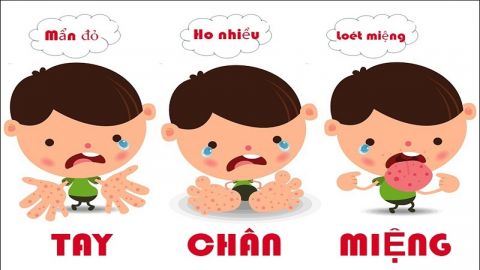 benh-tay-chan-mieng-hsmd