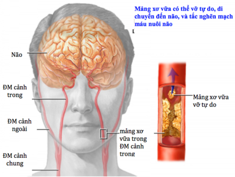 dot-quy-thieu-mau-cuc-bo