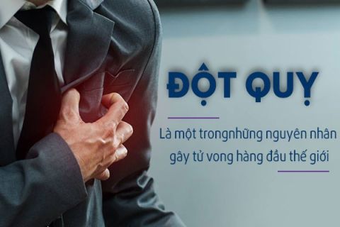 Thời tiết giao mùa, nhiệt độ thay đổi đột ngột rất dễ dẫn đến nguy cơ đột quỵ