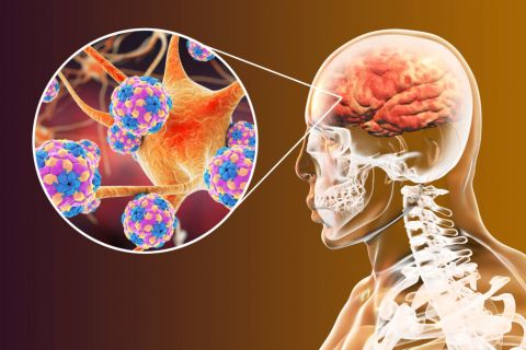 Biểu diễn đồ họa của enterovirus gây viêm não. Nguồn: Kateryna Kon (Shutterstock)