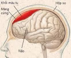 benh-nao-do-chan-thuong-man-tinh-cte