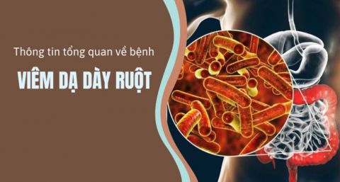 tong-quan-ve-viem-da-day-ruot