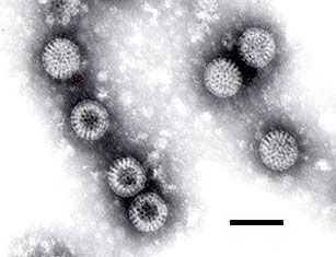 vac-xin-rotavirus