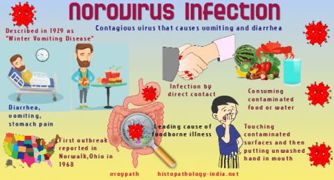 viem-da-day-ruot-do-norovirus