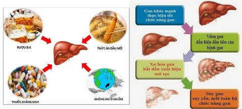 anh-huong-cua-benh-gan-len-chuyen-hoa-thuoc