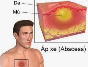 ap-xe