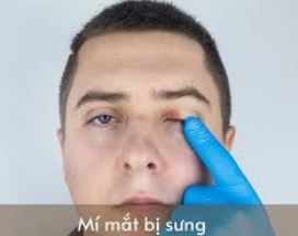 sung-mi-mat