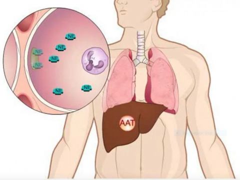 thieu-alpha-1-antitrypsin