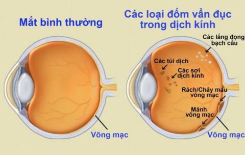 van-duc-dich-kinh
