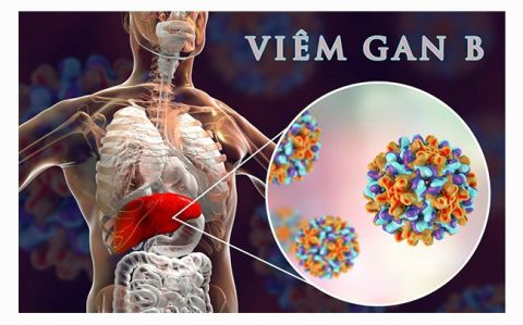 viem-gan-b-man-tinh