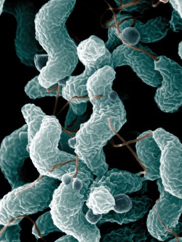campylobacter-va-cac-benh-nhiem-trung-lien-quan