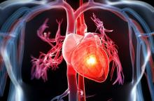 Bệnh tim mạch thuộc nhóm những bệnh nguy hiểm hàng đầu. Ảnh: medlatec.vn